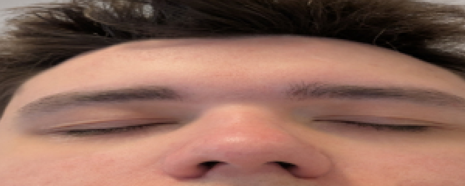 Stretched Face 2